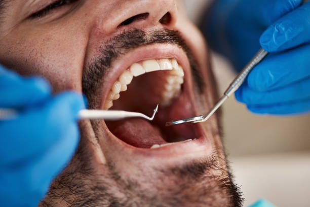 Best Pediatric Emergency Dentist in Glenmoor, OH